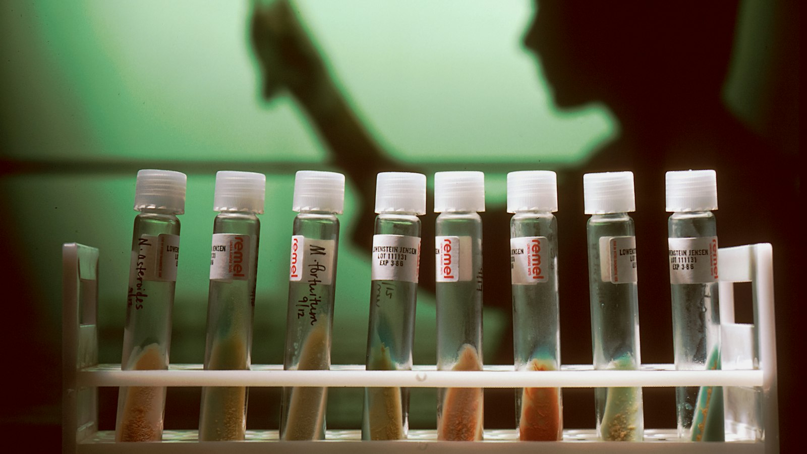 Rack of sealed research sample tubes in a laboratory